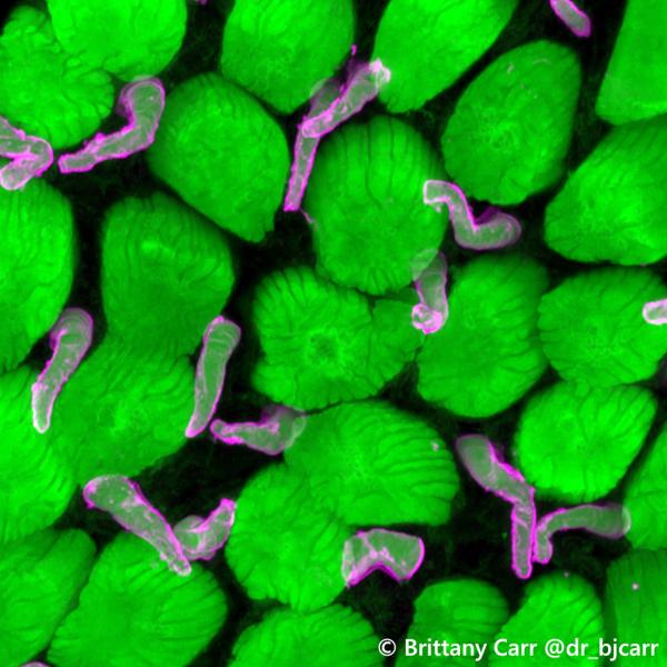 cross section of cones and rods